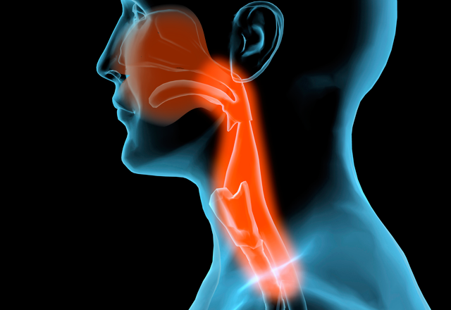 Head and Neck Cancer